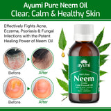 Pure Neem Oil