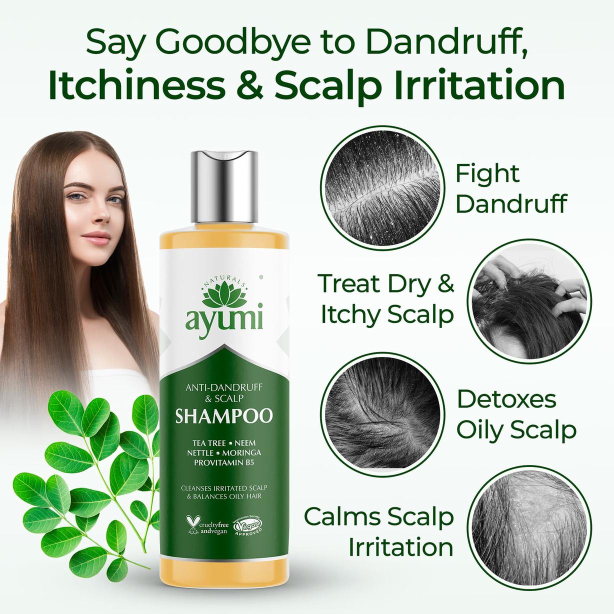Clarifying Anti-Dandruff Shampoo for Itchy, Flaky Scalp
