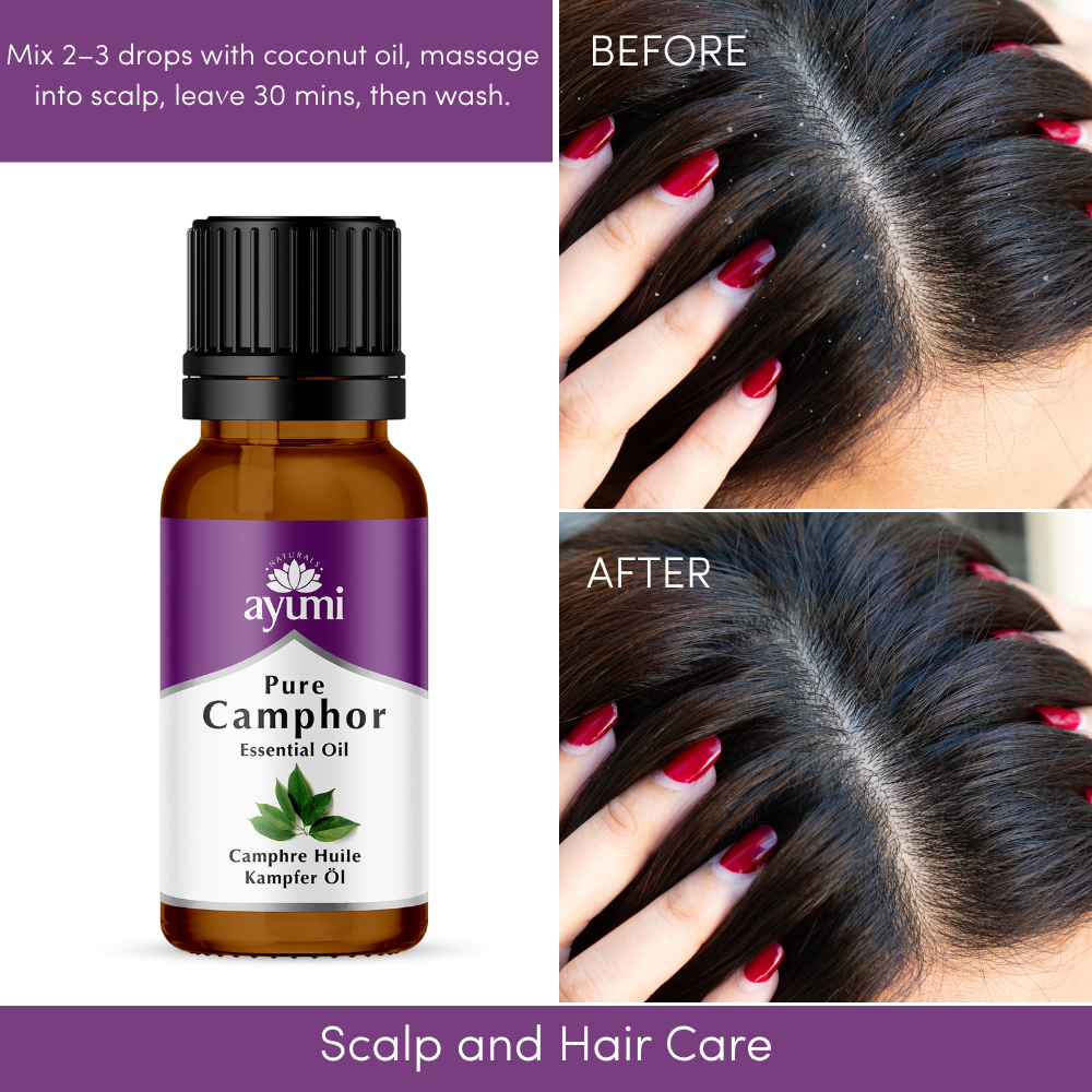 Ayumi Camphor Oil, showing head with dandruff and without