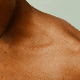 Dull Skin