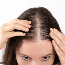 Hair Thinning
