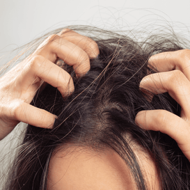 Itchy Scalp