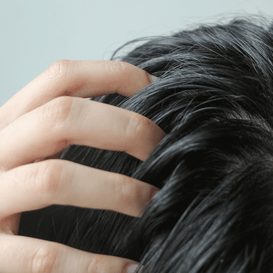 Oily Scalp