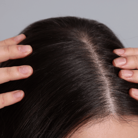 Scalp Treatment
