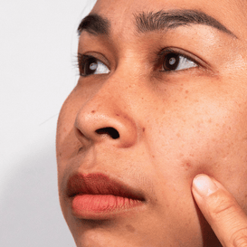 Dull Skin